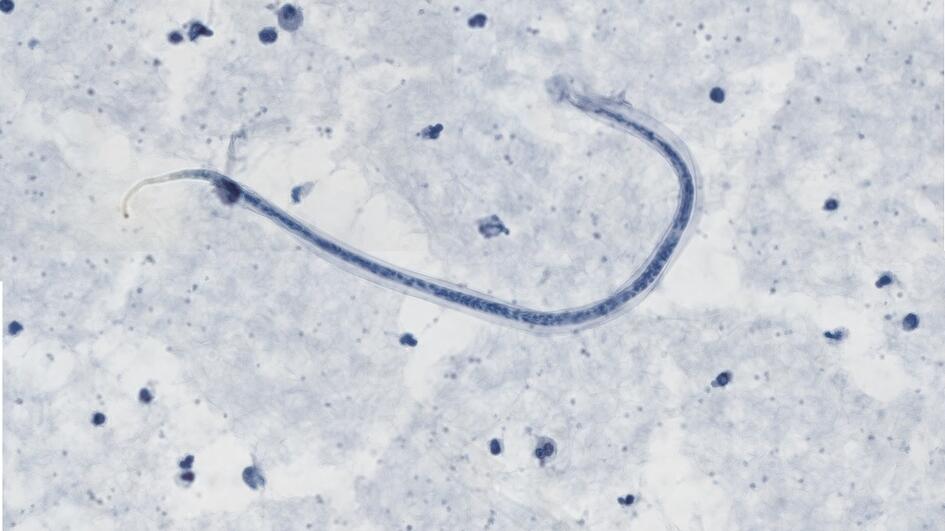 Microscopic image of roundworms roundworms) can survive even in freezing temperatures and pose risks to humans and pets long after the snow has melted.